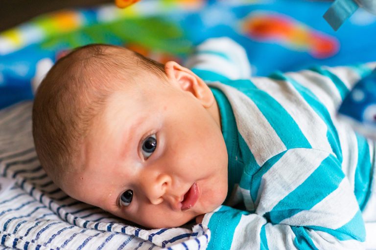 Flat-Head-(Plagiocephaly)